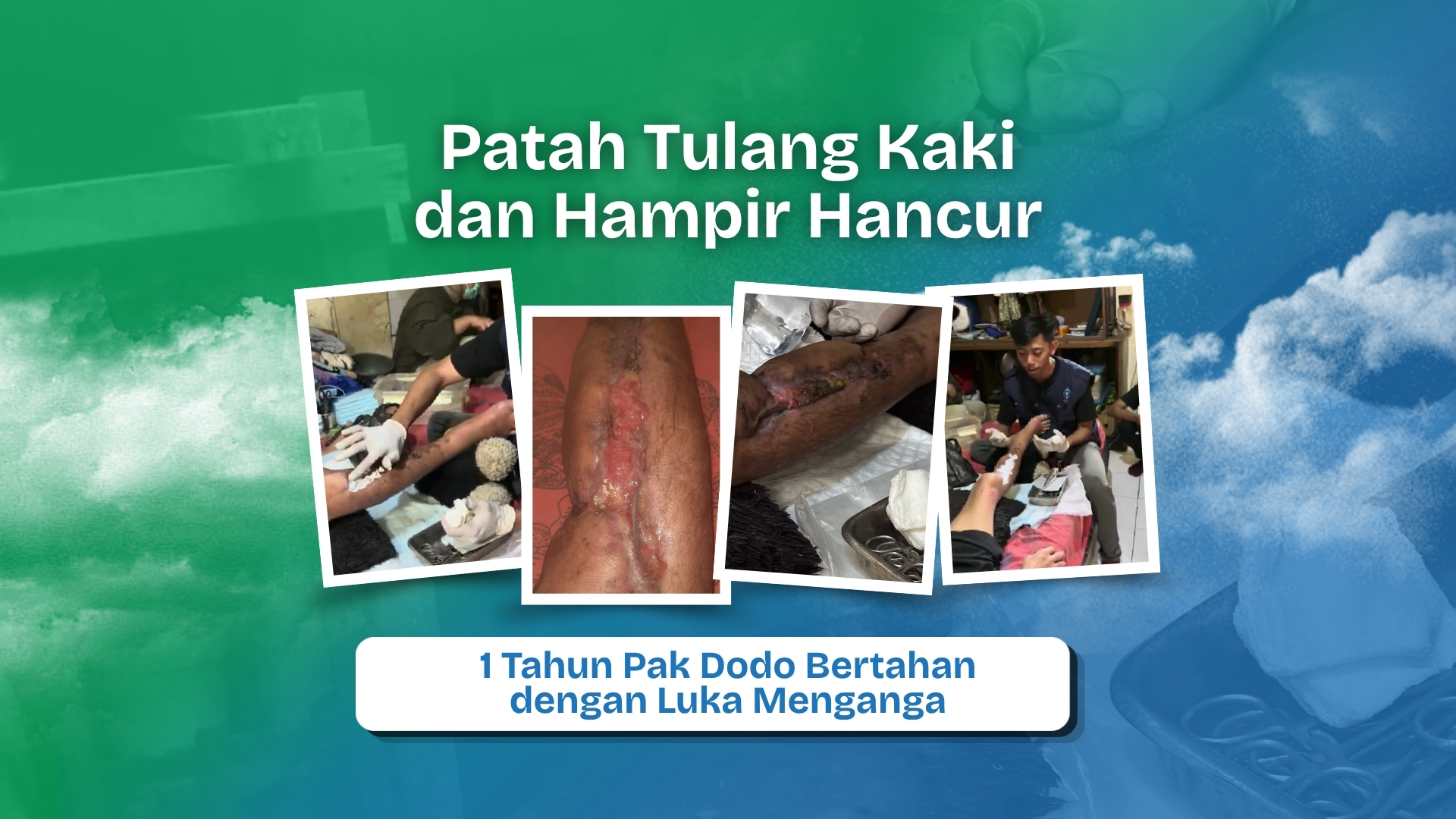 Bantu Ojol Korban Tabrak Lari Merawat Luka Hingga Tuntas